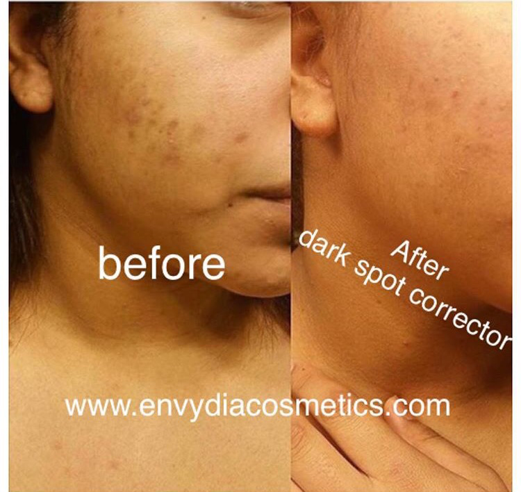 Dark Spot Corrector 30g