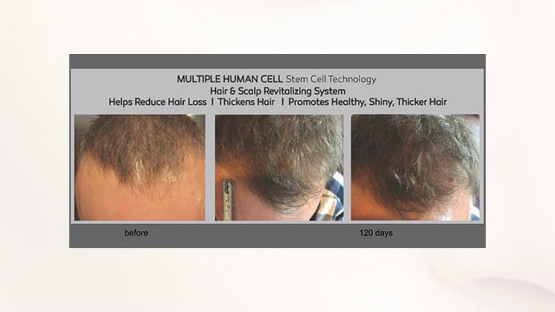 Hairlicious  Hair Re-Growth & Fortifying  Conditioner with MHCsc™ Technology