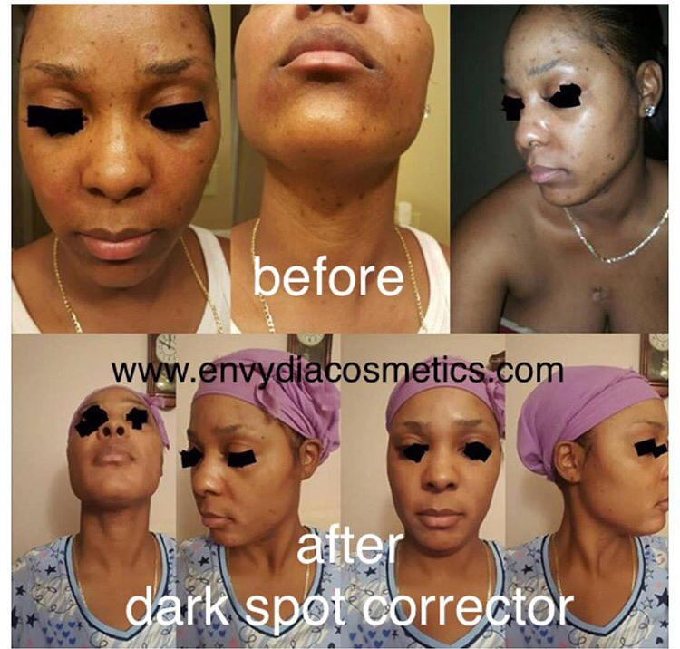 Dark Spot Corrector 30g