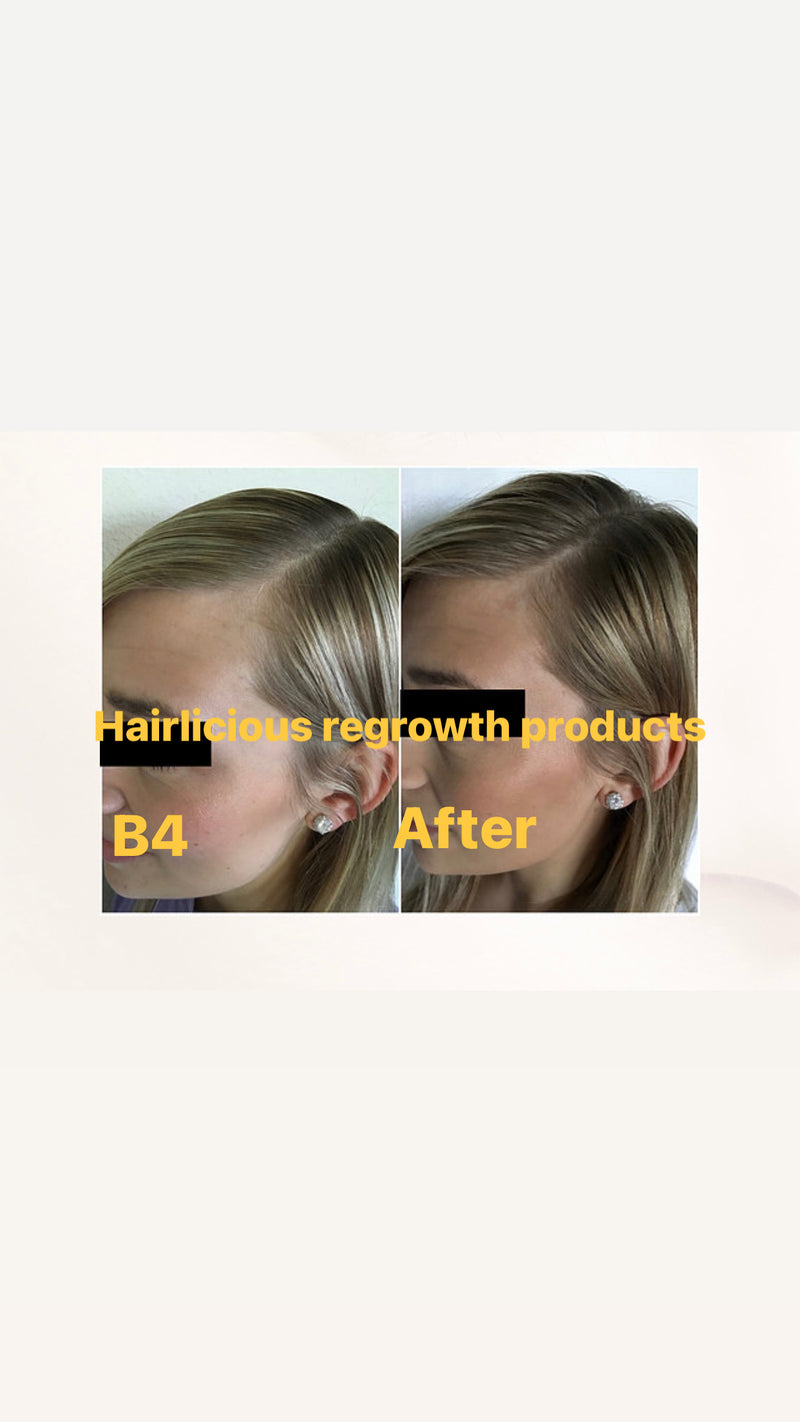 Hairlicious Regrowth Invigorating Shampoo