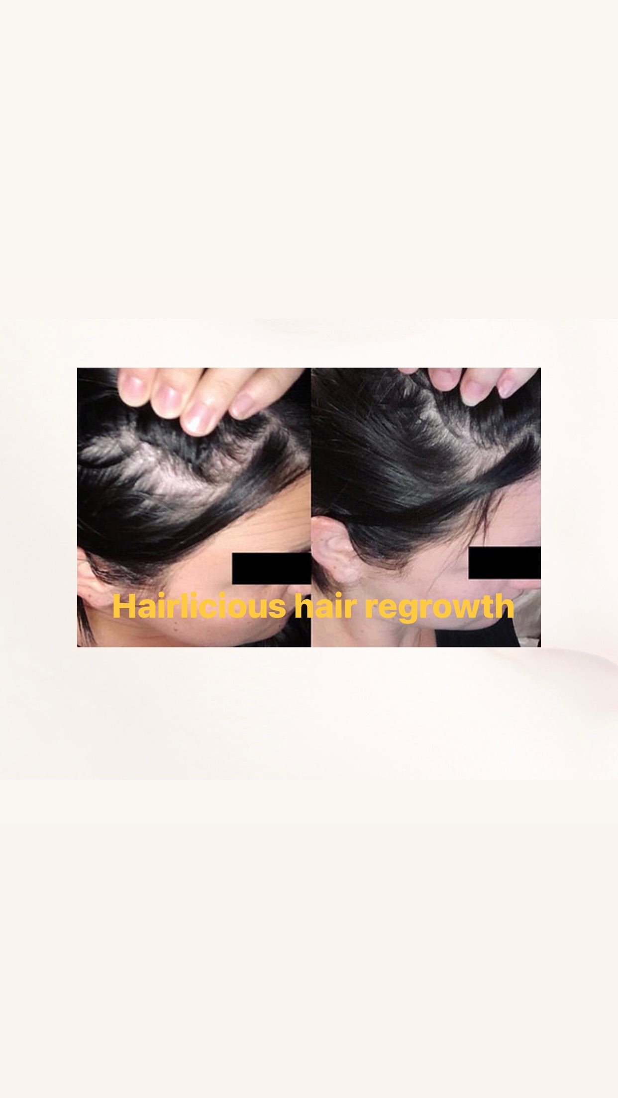 Hairlicious  Hair Re-Growth & Fortifying  Conditioner with MHCsc™ Technology